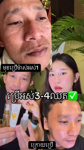 Replying to @_ Leakhena 🌸🍀អ្នកមានមុនខ្មូត ជាំអាចម៍រុយ មកប្រើឈុតយិនសិនបាន ✅ ទាក់ទងពិភាក្សារទិញតាម fb:Sa Lyly ឬtelegram:0979317437 #ឈុតយិនសិនកូរ៉េ💥 #salyly #salikabrand #ម៉ាស់យិនសុិនមាស💛 