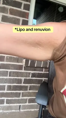#armlipo #lipo #looseskin #renuvion #liporenuvion @Surface360official 