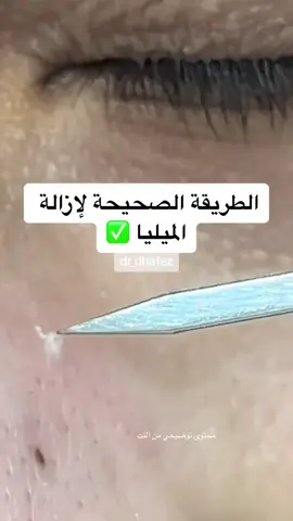 #ظافر_الحافظ #ظافر_ال_حافظ #ميليا#الميليا#علاج_الميليا