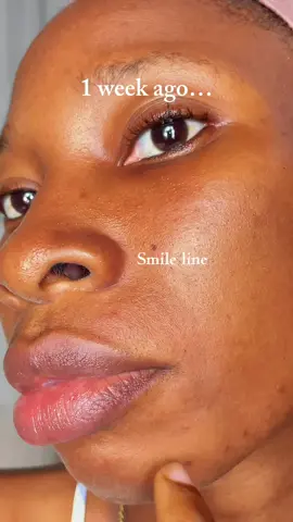 Glowy in 7 days #marynmay #marynmaypopchallenge #kbeauty #hyperpigmentation #glowingskin @Mary&May Official 