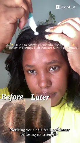 💆🏽‍♀️✨ Stronger, fuller hair starts at the scalp ✨ The Growsu Recover Therapy Hair Booster Serum helps prevent thinning and hair loss while refreshing and soothing your scalp. Formulated with salicylic acid, menthol, and dexpanthenol, it unclogs pores, strengthens from the roots, and boosts circulation for healthier growth — all without Minoxidil. 🌿💖 Your daily step toward thicker, healthier-looking hair! 🌸#GROWUS #HairBoosterSerum #HairLOSs @Growus 