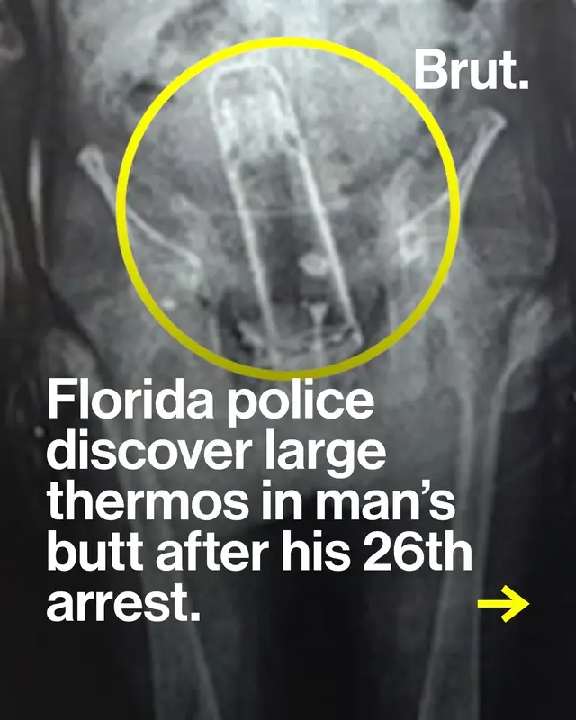 Florida police arrested a man who had a thermos lodged in his rectum this weekend.  #Florida #Thermos #Contraband #Smuggle #Arrest  Credits: Polk County Sheriff’s Office  Journalist: Jami Male