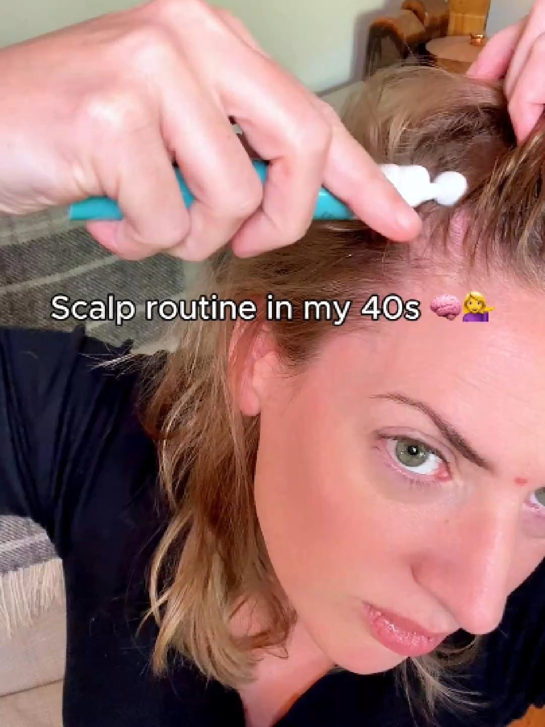 Hair changes in your 40s are hormonal.  As estrogen dips, follicles shrink and scalp buildup increases. The result? Thinner strands, slower growth, and that frustrating “my part looks wider” moment. It's time to switched to scalp-focused care. The GrowUs Recover Therapy Hair Booster Serum — Korea’s number one best-selling hair growth serum — uses salicylic acid to exfoliate the scalp, menthol to improve microcirculation, and dexpanthenol to strengthen the follicle barrier. @growus.official When you focus on scalp and hair follicle health instead of just the hair itself, you create the right conditions for stronger, denser, more resilient growth — even through perimenopause and beyond. It’s not about reversing time. It’s about working with your biology.  #GROWUS #HairBoosterSerum #HairLoss #ttspersonalcarepicks #tiktokshopcreatorpicks