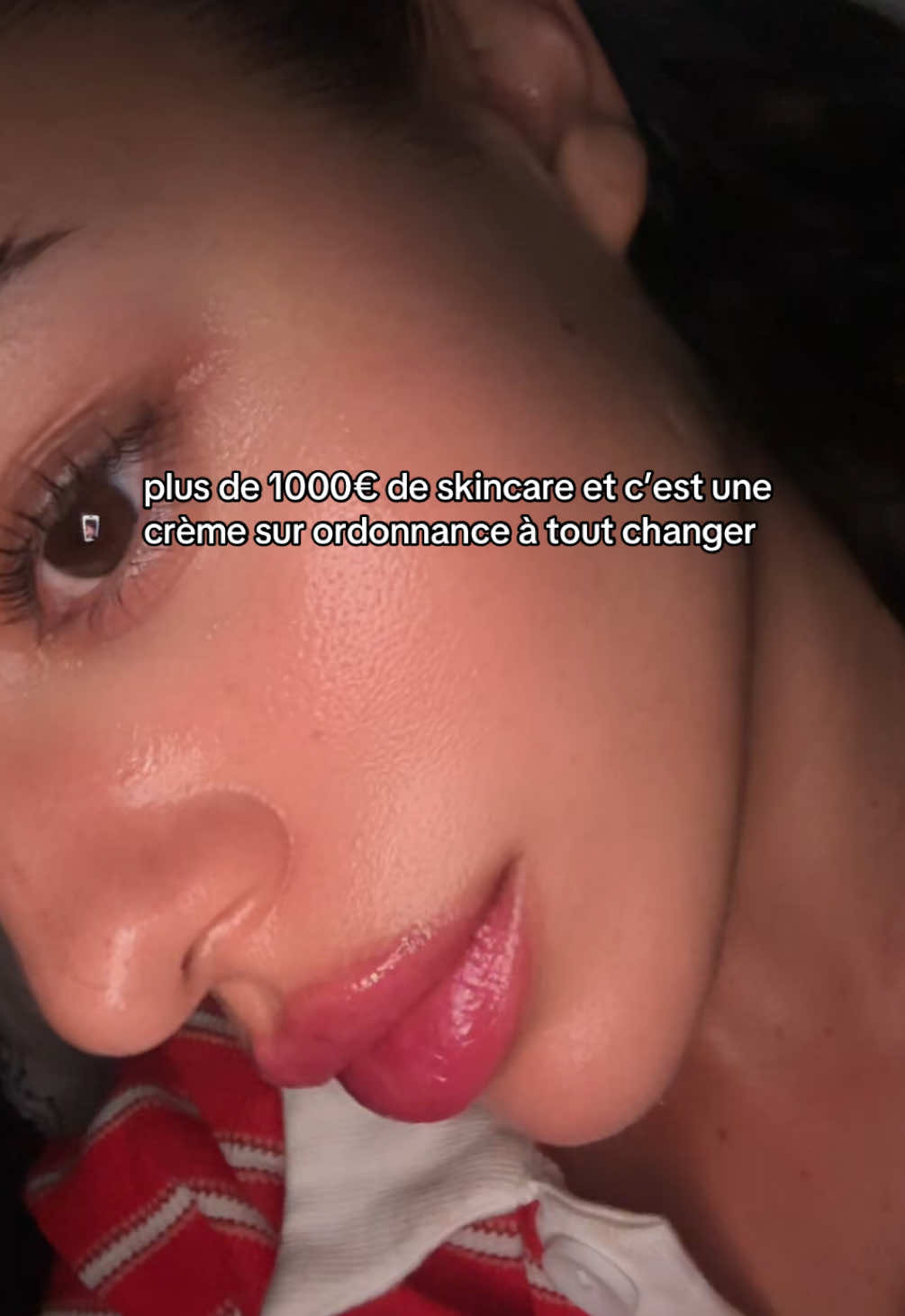 de jour en jour ma peau devient juste sublime !!! #skin #dermato 
