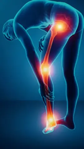 SAIBA IDENTIFICAR OS SINTOMAS DO OSTEOSSARCOMA.
