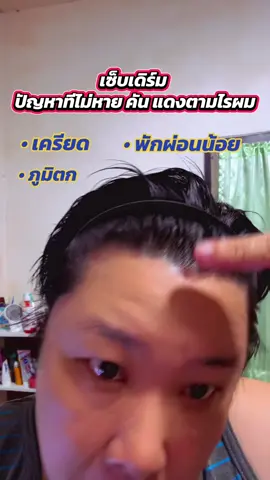 คนเป็นเท่านั้นจะเข้าใจ  คันแดง รำคาญสุด#เซ็บเดิร์ม #เซลซั่นบลู #แชมพูเซ็บเดิร์ม #tiktokshop1010ยกทัพแบรนด์แท้ #tiktok1010supersale 