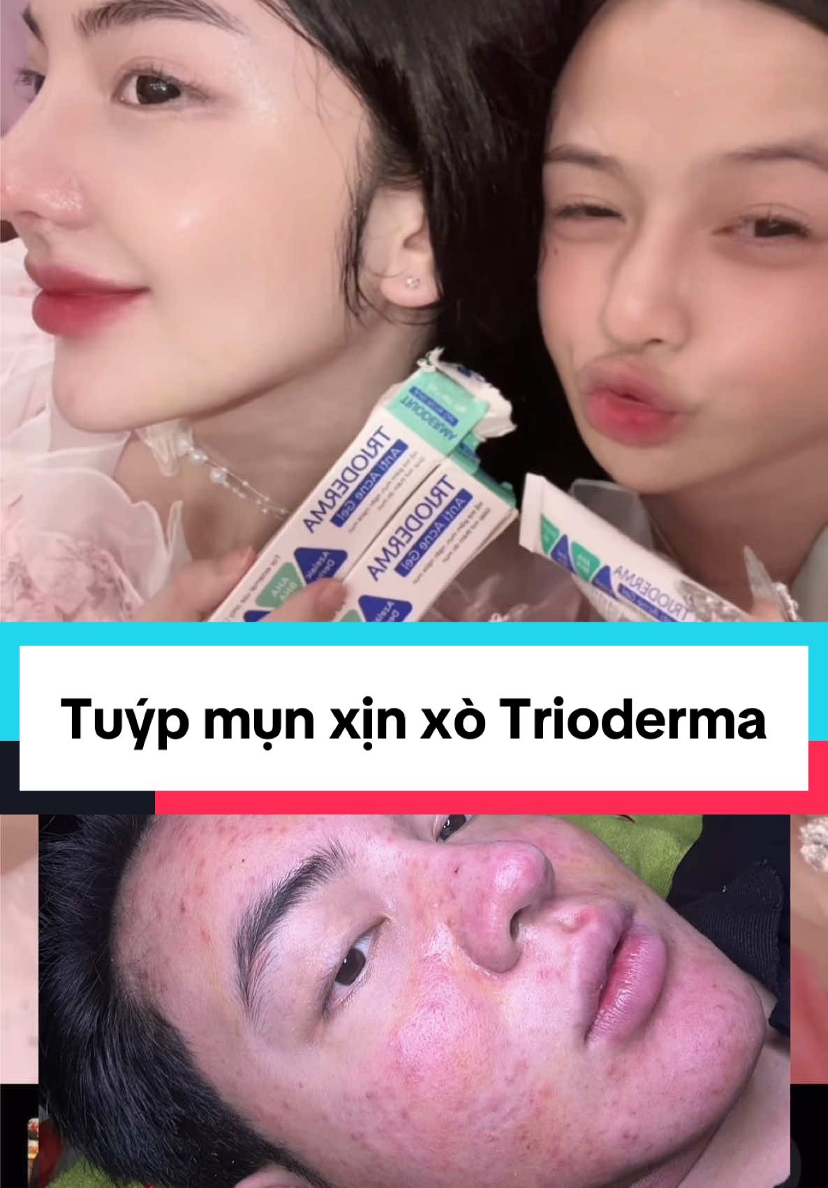 Hên da kịp hết mụn để về ăn cưới Như Chuu 👰‍♀️🤵. Ai xin vía k ạ ? Nhã vía cho những ai đang bị mụn nhoa 😚 #CapCut 