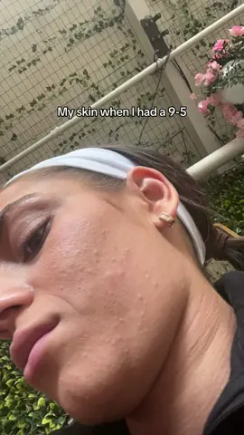 I’m allergic to corporate America (my skin isn’t perfect but it’s recovering)