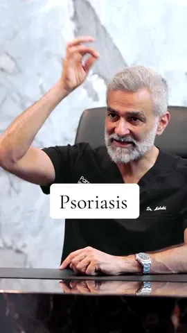 Dr. Mohebi educates us about how the psoriasis condition can impact hair and hair loss. | #HairLoss #Psoriasis #ParsaMohebiHairRestoration #FYP #FUE   