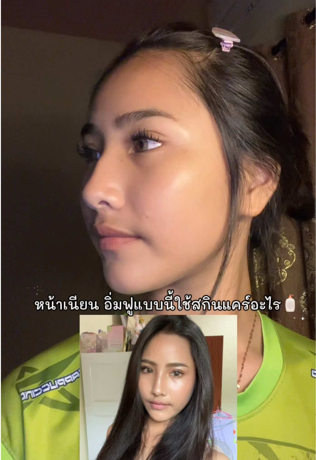 ลามิล่าทำถึง!#ครีมลามิล่า#ลามิล่า#ลดสิว
