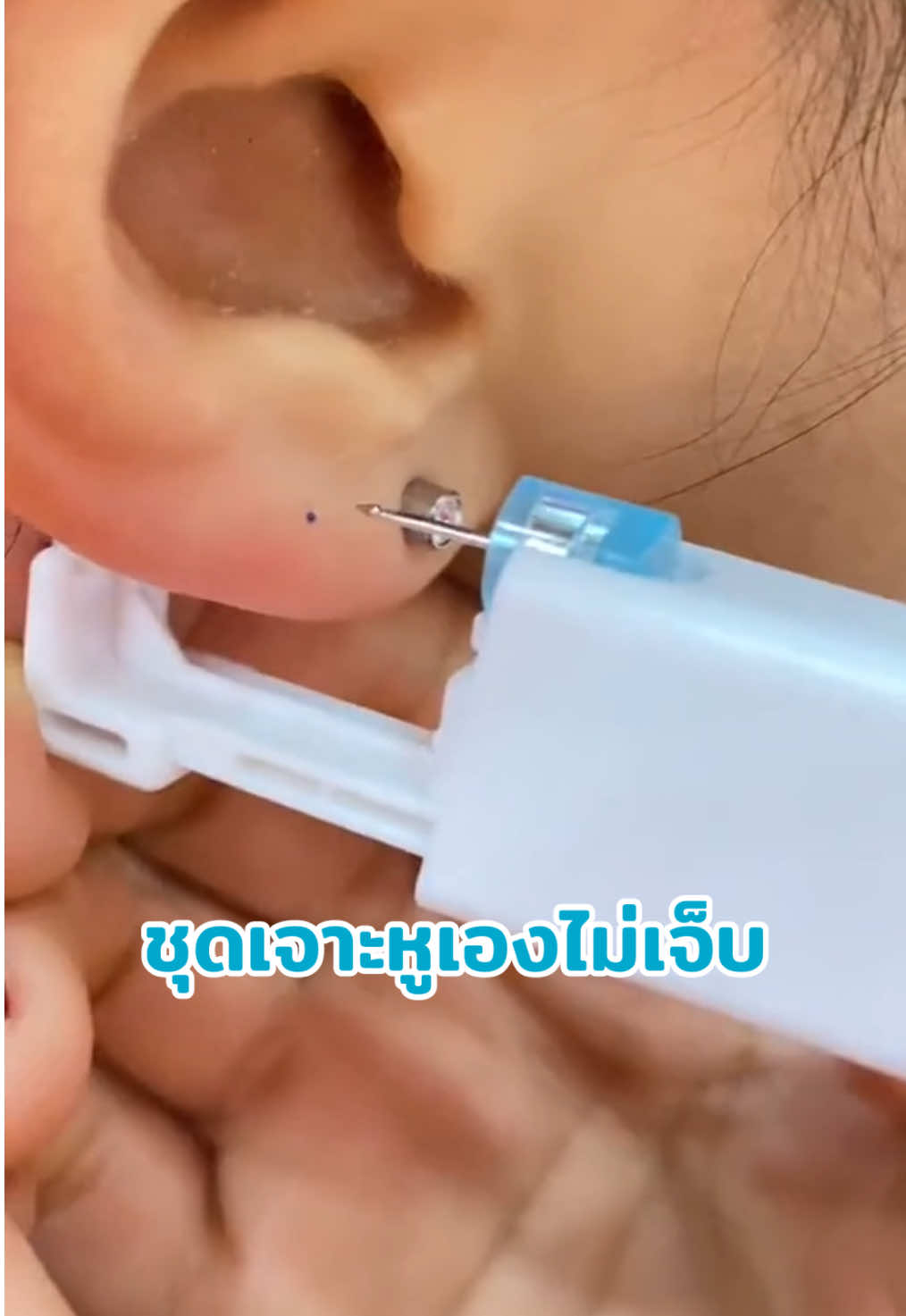 ✨ ที่เจาะหูปลอดภัย ดีไซน์ใหม่ เจาะง่าย ไม่เจ็บ ทำเองได้ที่บ้าน อยากเจาะหู แต่กลัวเจ็บ? ตอนนี้คุณสามารถมี ที่เจาะหูปลอดภัยแบบไม่เจ็บ ที่ช่วยให้ทุกคนเจาะหูได้ง่ายๆ ที่บ้านโดยไม่ต้องง้อร้าน! ชุด ที่เจาะหูสะอาดปลอดเชื้อ ของเราถูกออกแบบมาให้ใช้งานง่าย ปลอดภัย และเหมาะกับทุกเพศทุกวัย ไม่ว่าจะเป็นมือใหม่หรือคนที่อยากเจาะเพิ่ม ก็สามารถทำเองได้อย่างมั่นใจ ⸻ 💎 ปลอดภัยสูงสุดด้วยมาตรฐานการแพทย์ ทุกชิ้นของ ที่เจาะหูปลอดภัย ผลิตจากวัสดุสแตนเลสเกรดการแพทย์ ไม่เป็นสนิม ไม่แพ้ผิว และผ่านการฆ่าเชื้อด้วยระบบ UV ก่อนบรรจุในแพ็คสุญญากาศ คุณจึงมั่นใจได้ว่าทุกครั้งที่ใช้จะสะอาดและปลอดภัย 100% ด้วยเทคโนโลยี เจาะแบบสปริงนุ่ม ลดแรงกระแทก ทำให้เจาะได้เรียบและไม่รู้สึกเจ็บ ช่วยให้ประสบการณ์เจาะหูของคุณง่ายกว่าที่เคย ⸻ 💫 ทำเองได้ง่าย ไม่ต้องกลัวผิดพลาด แค่เลือกตำแหน่งที่ต้องการ เจาะได้ทันทีภายในไม่กี่วินาที! ที่เจาะหูสำหรับมือใหม่ รุ่นนี้มาพร้อมระบบล็อกอัตโนมัติ ป้องกันการเจาะผิดตำแหน่ง เหมาะสำหรับคนที่อยากลองเจาะหูเองที่บ้านโดยไม่ต้องกลัว ภายในชุดมีครบทั้ง ต่างหูสแตนเลสปลอดภัย, ถุงมือปลอดเชื้อ, สำลีแอลกอฮอล์ และคู่มือการใช้งานแบบ Step-by-step เข้าใจง่าย ⸻ 💧 สะอาดทุกขั้นตอน ดูแลง่ายหลังเจาะ ไม่ต้องกังวลเรื่องแผลอักเสบหรือการติดเชื้อ เพราะ ที่เจาะหูสะอาด ของเราผ่านการฆ่าเชื้ออย่างเข้มงวด หลังเจาะ เพียงเช็ดทำความสะอาดบริเวณแผลด้วยแอลกอฮอล์วันละ 1–2 ครั้ง ก็เพียงพอให้แผลหายไว ไม่บวม ไม่เจ็บ และไม่ทิ้งรอย ⸻ 💰 ประหยัด คุ้มค่า และปลอดภัยกว่าไปเจาะที่ร้าน ในยุคที่ต้องใส่ใจสุขอนามัย การเจาะหูที่บ้านคือทางเลือกใหม่ที่ทั้งสะดวกและปลอดภัย ที่เจาะหูทำเองได้ที่บ้าน ของเราใช้งานง่าย ไม่ต้องพึ่งช่าง ไม่ต้องเสี่ยงสัมผัสใกล้ชิด ประหยัดเวลาและค่าใช้จ่าย แต่ได้ผลลัพธ์เหมือนเจาะจากร้านมืออาชีพ ⸻ 🔹 จุดเด่นของที่เจาะหูรุ่นนี้ 	•	✅ ปลอดภัยผ่านการฆ่าเชื้อ 	•	✅ เจาะง่าย ไม่รู้สึกเจ็บ 	•	✅ เหมาะสำหรับมือใหม่ 	•	✅ ใช้ได้ทั้งชายและหญิง 	•	✅ มีอุปกรณ์ครบชุด พร้อมใช้งานทันที #ที่เจาะหูปล#ที่เจาะหูปลอดภัยี#เจาะหูเองที่บ้านก#ไม่เจ็บไม่กลัวช#สะอาดปลอดเชื้อเลส