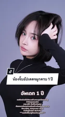 น้องจิ๊บ @jarryme ดาวต๊อกๆ อัปเดตจมูก 1 ปี #หมอผิงnsc เทคนิคโอเพ่นหลังหู เคสเสริมใหม่ หลังทำไป 1 ปีบอกเลยมุมไหนก็สวย ✨ แต่งหน้าง่ายขึ้น ลุคไหนก็เอาอยู่ 