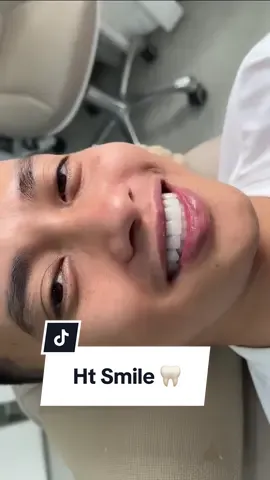 Chiếc sứ trong veo cho anh khách nhà Han . Đẹp xĩu 🤍🦷🤍 #HanDental  