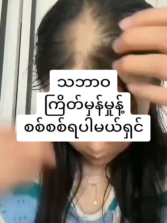 #ခိုင်ကြိတ်မှန်ရွက်အမှုန့် #ဆံပင်ပြသနာရှိသူတိုင်းကြည့်ပေးပါ #အိမ်ရောက်ငွေချေပို့ပေးပါတယ်ရှင့ #09698397251ကိုဆက်သွယ်မှာယူနိုင်ပါတယ်ရှင် 