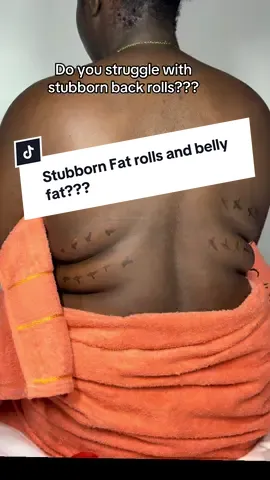 Tired of hiding your back fat under clothes? 😩💉 This Lipolysis treatment targets stubborn back rolls that won’t move no matter how much you diet or gym. At Innermost Peace Body Spa, we help you melt the fat and love your body again 🤎✨         #Lipolysis #BackRollsGone #BodySculpting #FatDissolving #SnatchedBack   