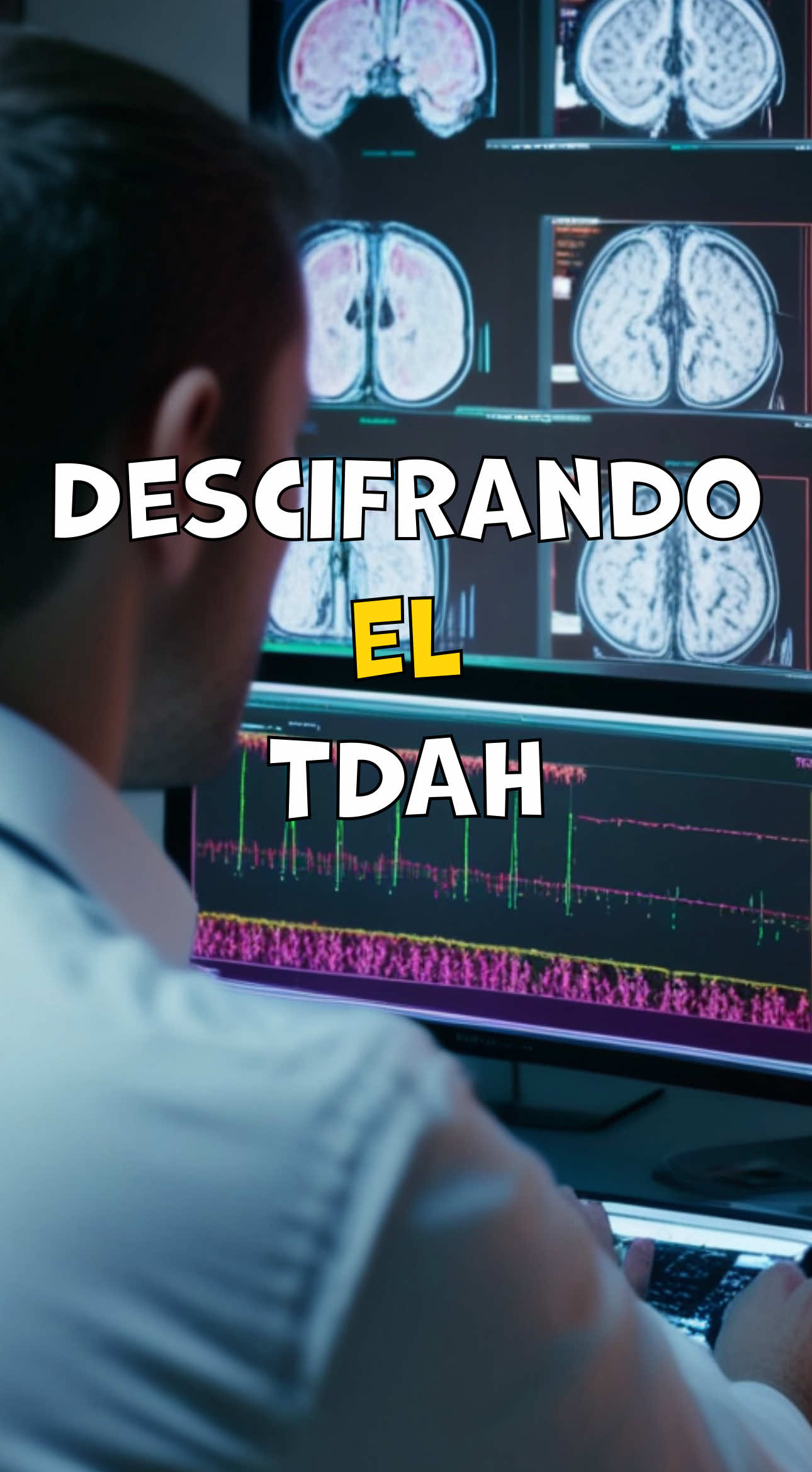 Descubre la verdad detrás del TDAH y por qué no se trata simplemente de falta de concentración. Este video explora cómo la química del cerebro afecta a quienes tienen TDAH, resaltando diferencias en la producción de dopamina y noradrenalina. A través de escenas informativas y visuales impactantes, entenderás que el TDAH es una variación en la forma de procesar la información, no un defecto de conducta. Aprende sobre la importancia de un manejo adecuado que incluya terapia, ejercicio y, en algunos casos, medicación. La próxima vez que escuches 'tengo TDAH', recuerda que es un cerebro que funciona diferente, no que funcione mal. #TDAH #SaludMental #Neurobiología #Dopamina #Terapia 