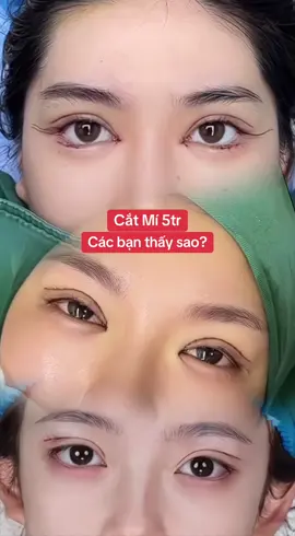 Nhiều bạn thắc bác catmi bên bs Khoa #catmi #nangmui #treocungmay #cangdamat #TikTokAwardsVN 