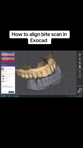 #digitaldentistry #drmustafaelsheikh #exocad #fybbbbbbbbbbbbbb 