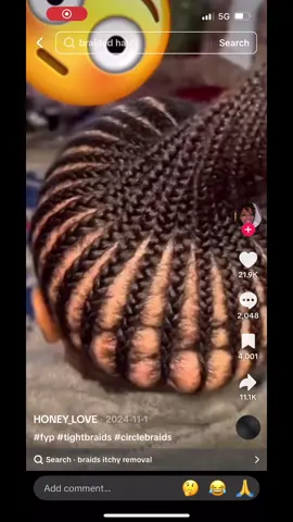 Just take out your hair using some @BASED and let it breathe. We need to have a word with Whoever braided your hair 🧍‍♂️#ref#refmikea#braidsa#scalp