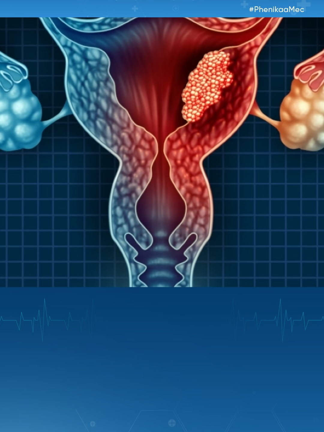 Xét nghiệm gen định loại HPV #phenikaamec #hpv