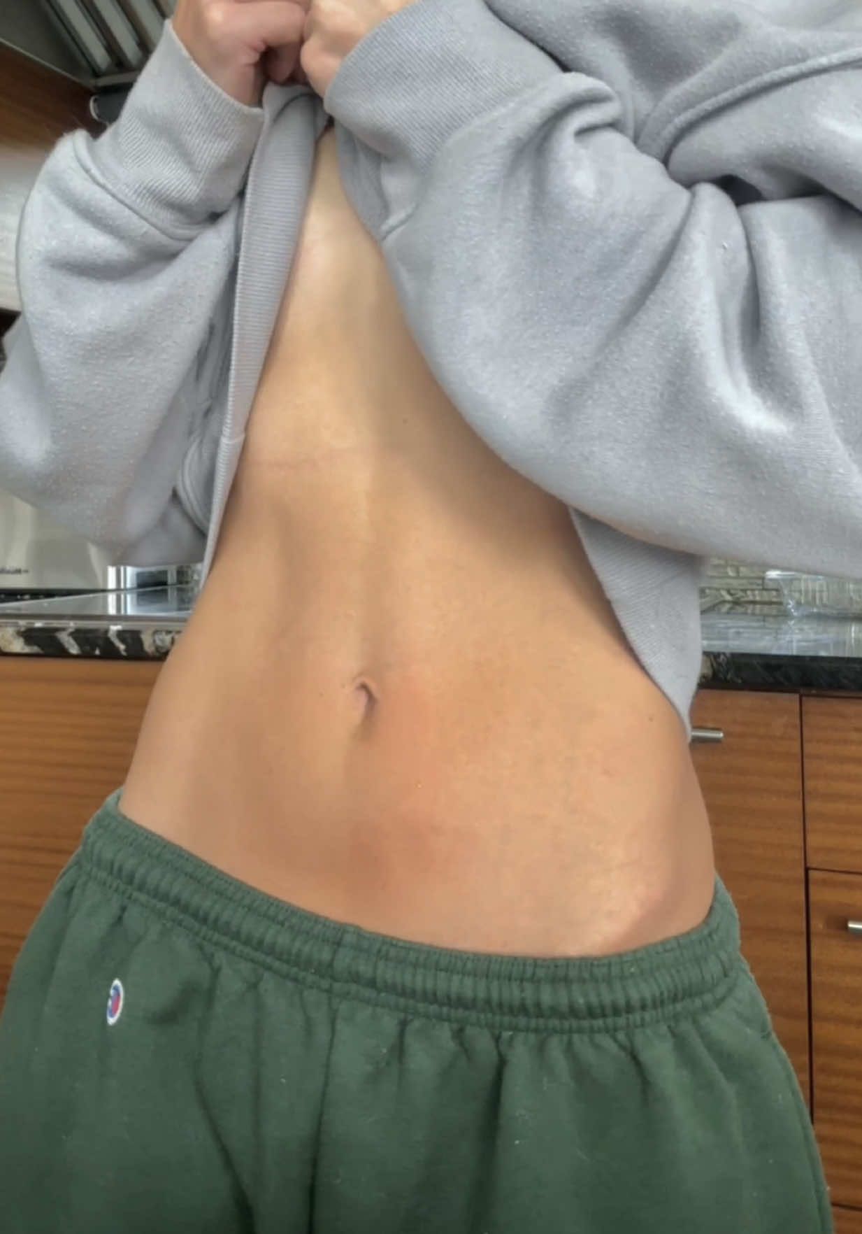 NAD+ week 3!!! I hate needles but it really doesn’t hurt. @He & She MD  https://heandshemd.com/she-md/