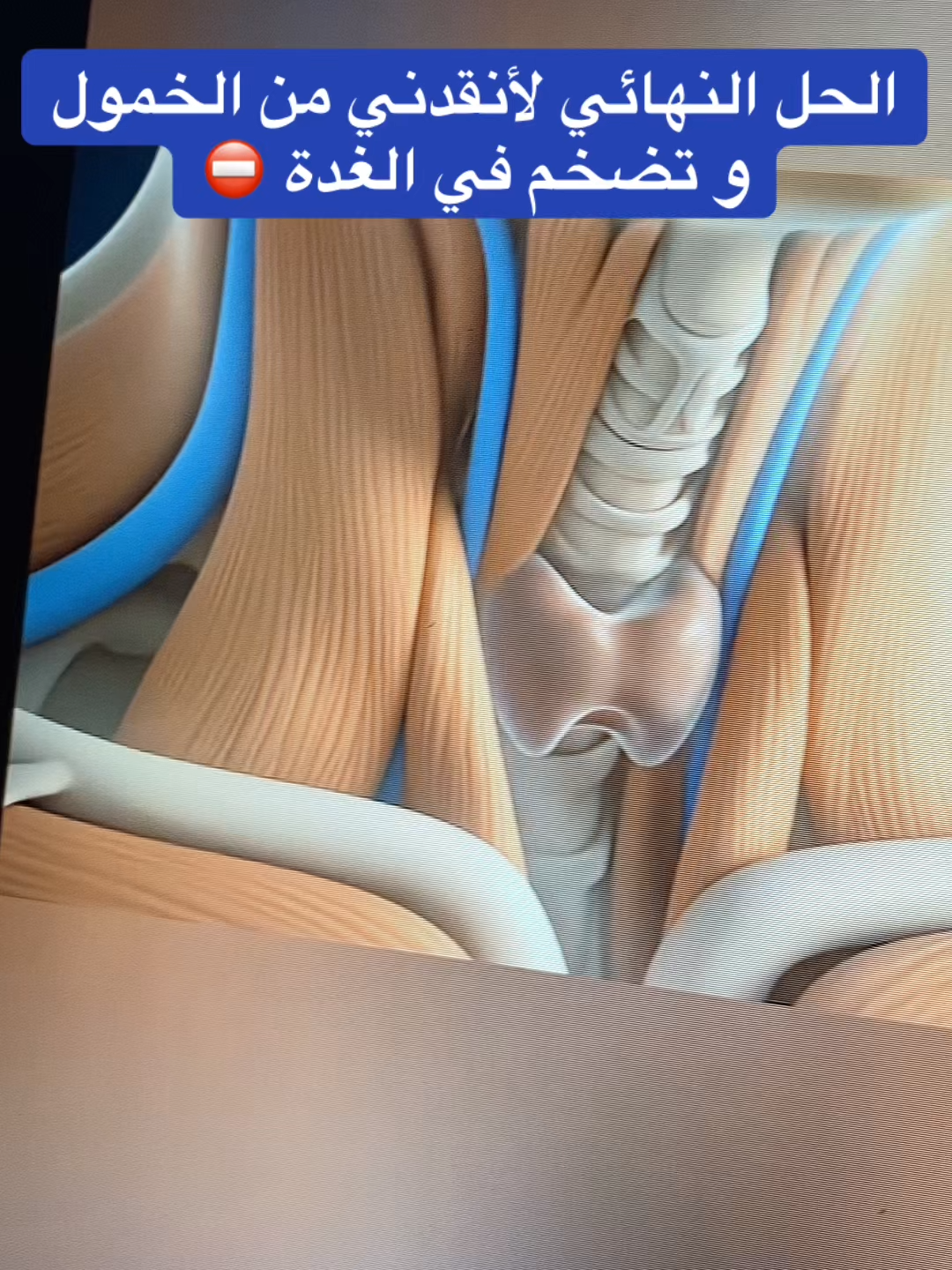 #الغدة_الدرقية #خمول#قولون_هضمي #قولون_معدة_غازات_إنتفاخات_إمساك_حموضة #إنتفاخ_البطن_والأمعاء #الرياض_جده_مكه_الدمام_المدينه #الرياض_الآن🇸🇦🇸🇦 #مكة_المكرمة_السعودية #السعودية_الكويت