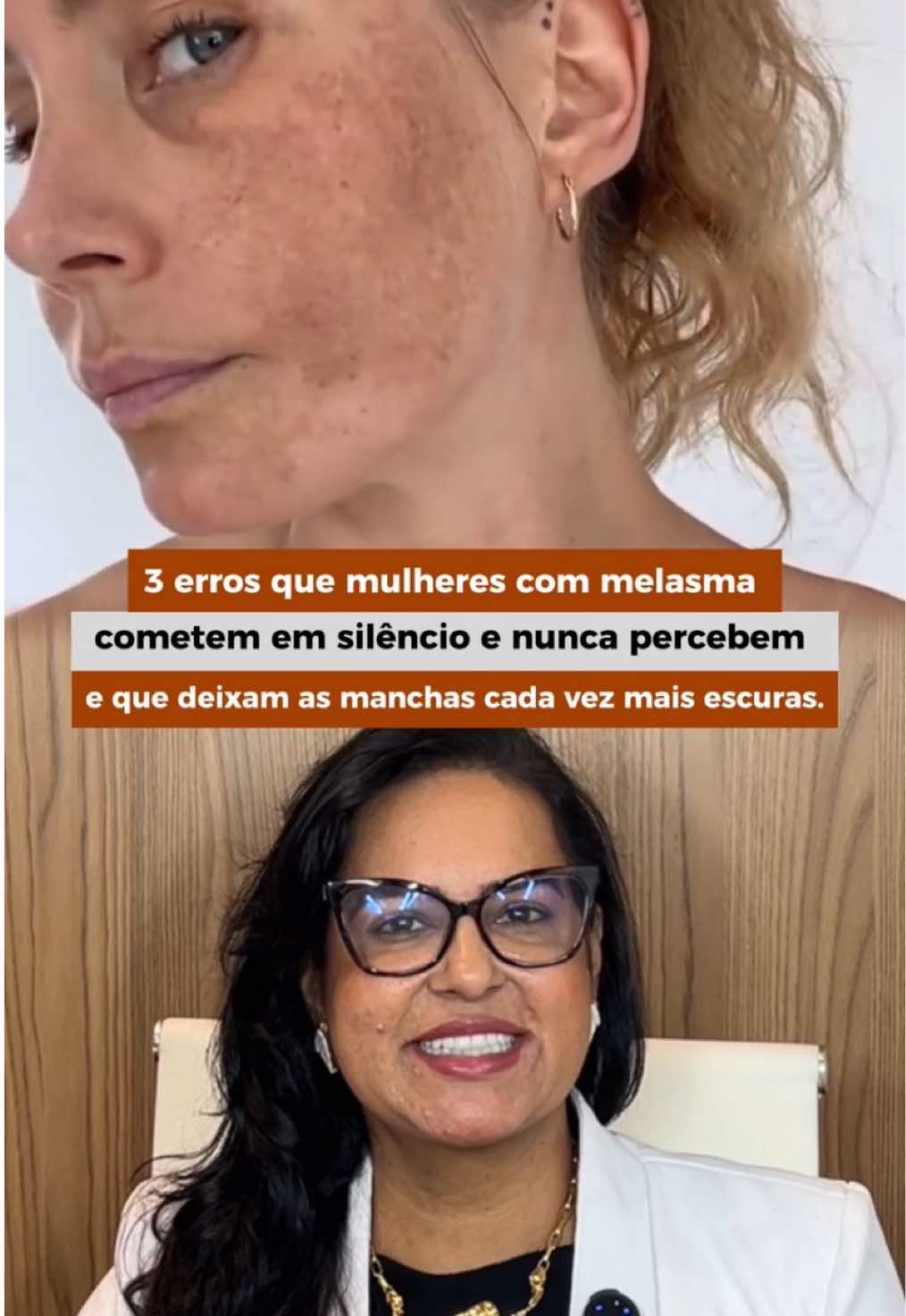 🔍 Tem algo que está escurecendo ainda mais suas manchas… e você nem desconfia. ⠀ Muitas mulheres acham que estão fazendo tudo certo contra o melasma, mas alguns erros silenciosos no dia a dia estão sabotando todo o tratamento. ⠀ É o tipo de informação que ninguém te conta nos cuidados com a pele… mas que faz TODA a diferença nos resultados. ⠀ Assista até o final e entenda o que pode estar dificultando sua jornada contra o melasma. ⠀ 📲 E se fizer sentido pra você, compartilhe com alguém que precisa ouvir isso também. . . . . #estética #clinicavanessacabral #cuidadoscomapele #melasma 