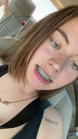 How Do We Feel ?💔💔#fyp #bracesremoval #sad #whitegirl 