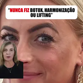 LINK NO MEU PERFIL !!! #spf #wrinklesbegone #lookyoungerthanmyage #skincarehacks #lookyounger #skinrenewal #facialfirming #ageisjustanumber #reducewrinkles #skinrepair #wrinkleprevention #dermalcare #finelines #glowupchallenge #skinboost #youthfulglow #foreveryoungskin #skininspiration #tightenskin #agedefined #renewedskin #antiagingresults #rugasnatestanuncamais #botox #fillers #pelesemrugas #rejuvenescimento #antiaging #skincare #wrinkles #antiagingskincare #skincareroutine #beauty #glowingskin #retinol #collagen #facial #skincaretips #aginggracefully #healthyskin #selfcare