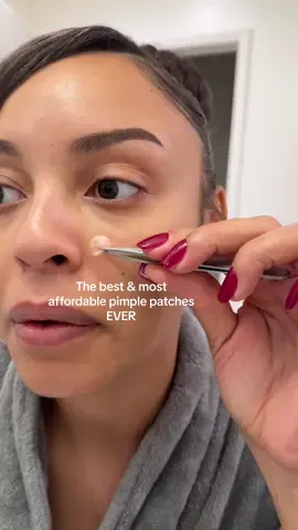 Treat those pimples & save money with @Livaclean patches 🙌🏽 #pimplesolution #pimpleremover #pimplepopperaddict 