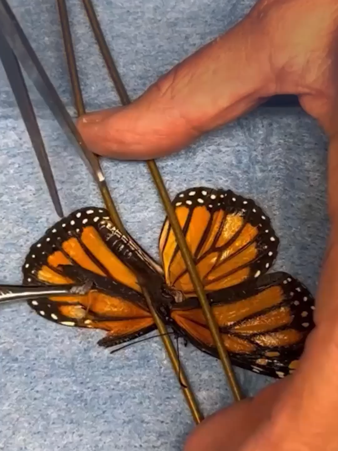 🦋 Una mariposa monarca herida pudo volver a volar tras ser sometida a un trasplante de alas en una reserva natural de Long Island, Nueva York. Las imágenes del Sweetbriar Nature Center muestran al insecto durante la curiosa intervención y luego, retomando su vuelo. Las mariposas monarca son las únicas mariposas conocidas que migran en dos direcciones a lo largo de miles de kilómetros cada año, según el Departamento de Agricultura de los Estados Unidos.