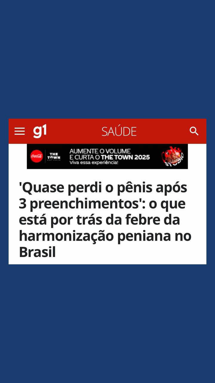 🚨 Cuidado com o PMMA no pênis! O preenchimento com PMMA é permanente e pode gerar complicações graves: inflamação crônica, deformidades, dor, dificuldade sexual e até cirurgias mutilantes. E quando feito por profissionais que não são médicos, o risco é ainda maior. 👉 Mas existe uma opção segura e reversível: o ácido hialurônico, aplicado por urologistas e dermatologistas habilitados. Ele permite ajustes, tem previsibilidade e pode ser dissolvido em caso de necessidade. ⚠️ Para qualquer procedimento íntimo, escolha sempre um médico especialista. Sua saúde e segurança vêm em primeiro lugar.