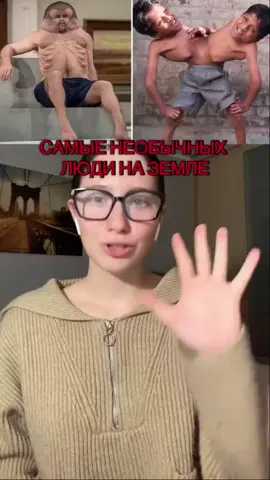 О таких фактах ты точно не знал! 😱#интересныефакты #кожа #хйу #мем #гадкийя @дизайнер одежды для рыб @Степашка лопатка @фу блин какишь@ 