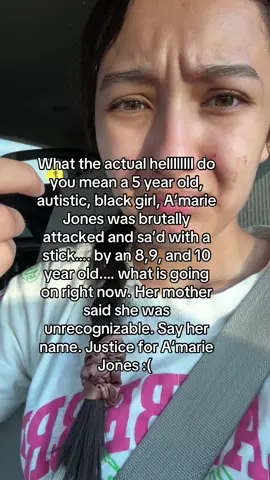 PETITION LINK IN THE COMMENTS PLEASE SIGN IT !!!! JUSTICE FOR A’MARIE JONES I cannot believe how disgusting and vile some people are. Cuz what do you mean kids did this… and it’s so weird that I can barely find any news outlets and articles about her like what are we doing people !!!! God bless her and her family I hope she has a fast recovery poor baby ☹️ #justiceforamariejones #sayhername #amariejones #awareness 