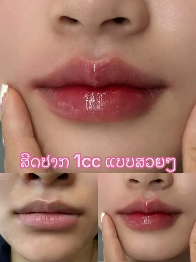 ປຶກສາຫມໍໂດຍຕົງທັກເບີຫນ້າໂປຣຟາຍ #ສາມຫຼຽມຄໍາ金三角特区🇱🇦 #เทรนด์วันนี้ 