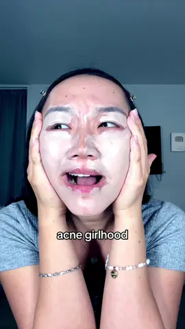 I wish I was prettier #acne 