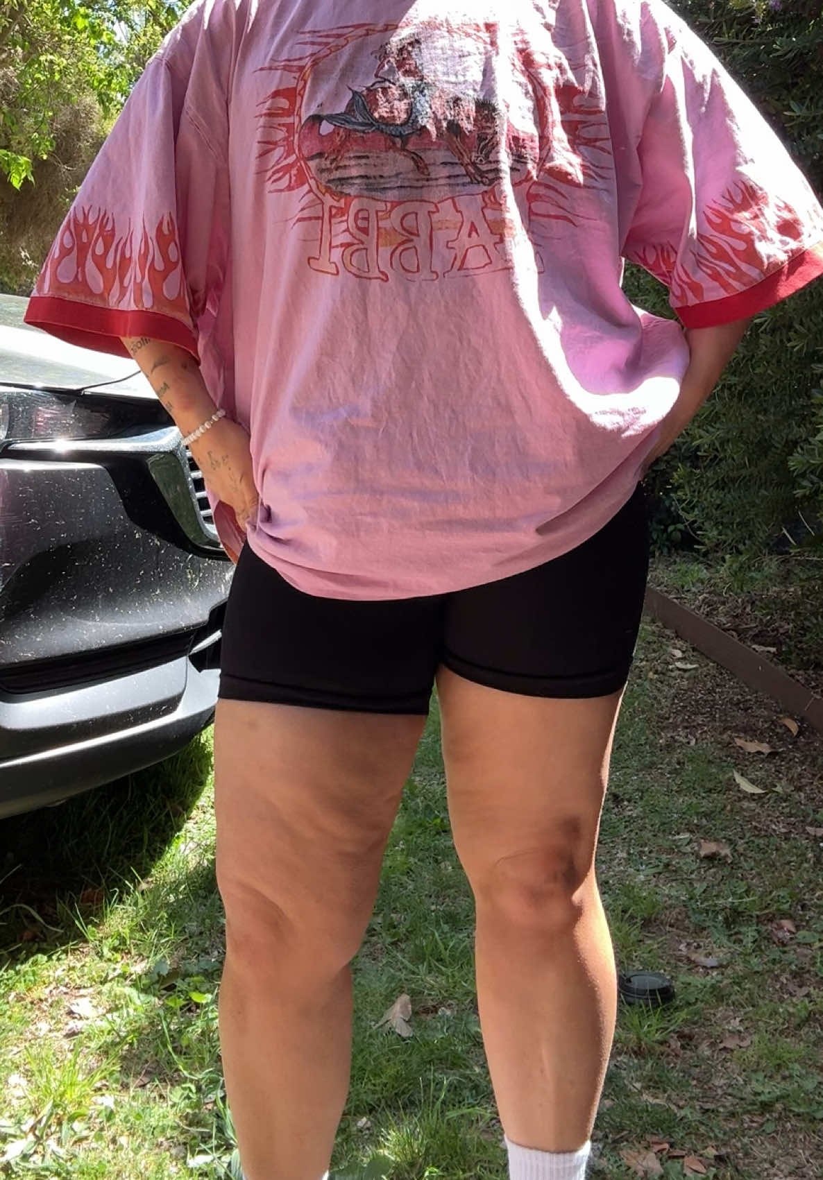 Lipedema is no joke. @Brittney Saunders thank for putting your video up today! Wear those shorts 😻😮‍💨 #lipedema #girl #fyp #foodforthought 