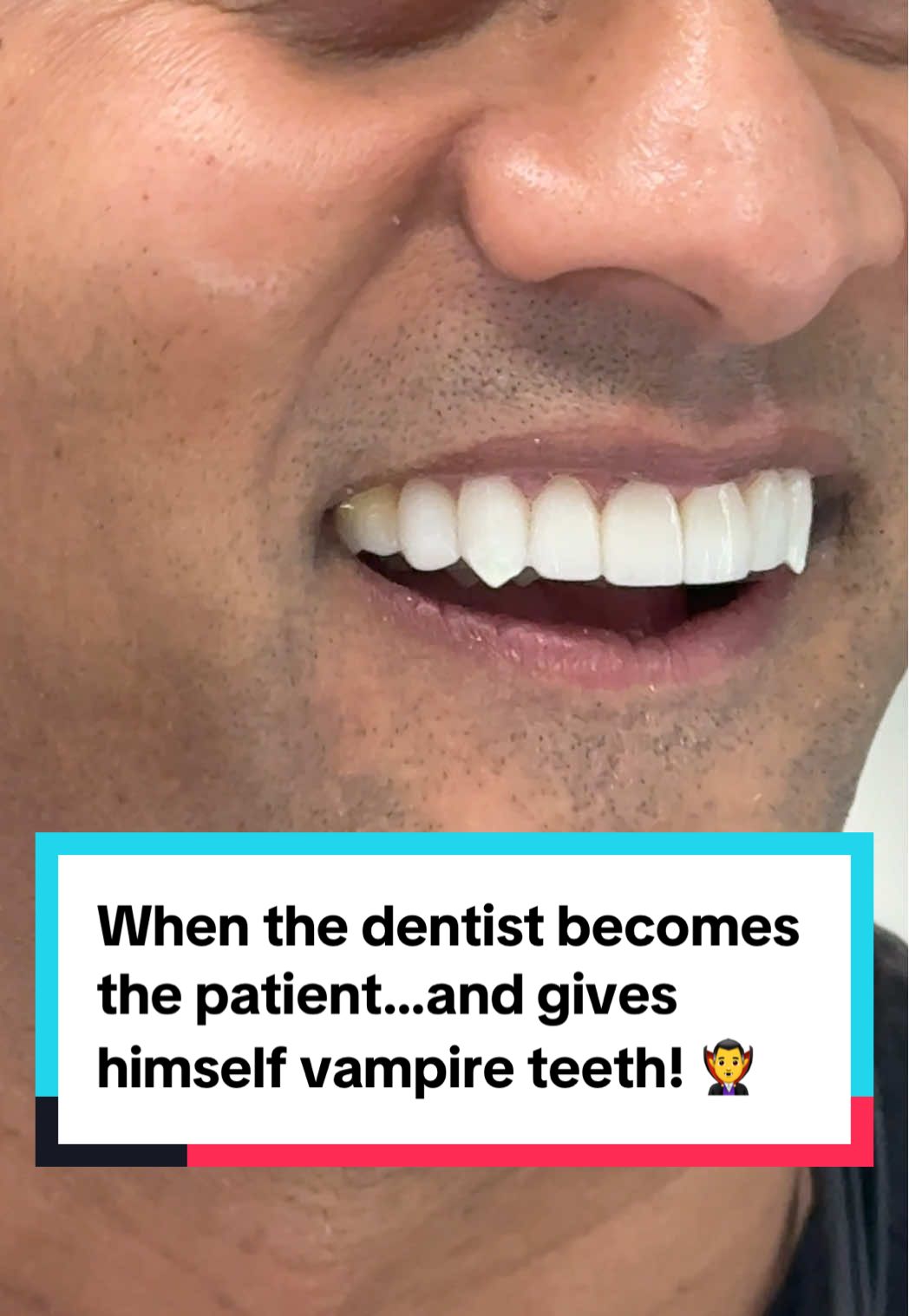 When the dentist becomes the patient…and gives himself vampire teeth! 🧛‍♂️ #vampire #teeth #halloween #fangs #vampireteeth 