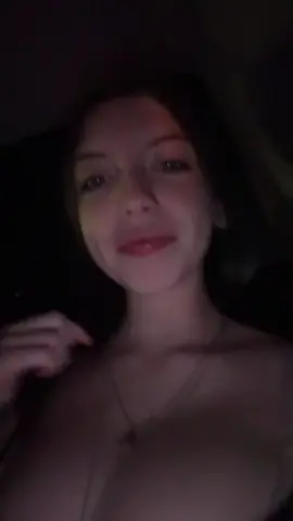 #fyp #boptok #fypシ゚viral #blowthisup #braces 