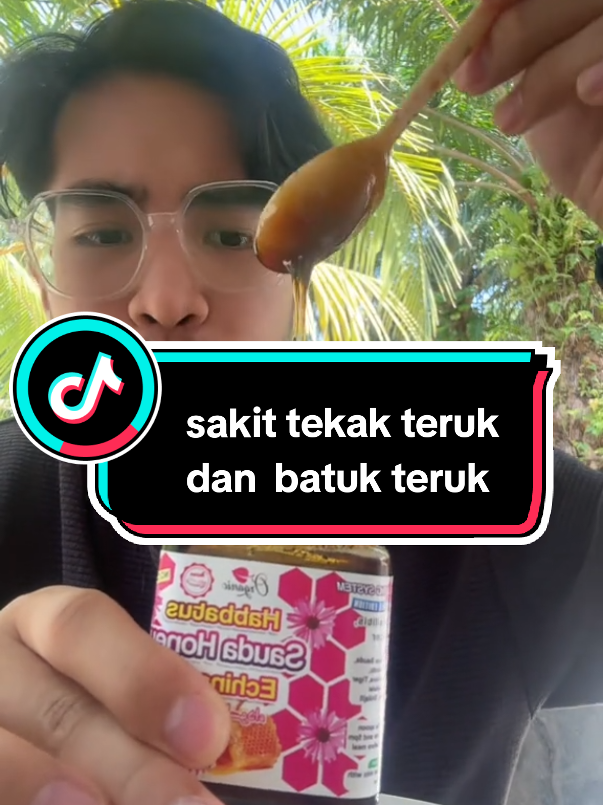 #maduhabbatussauda #radangparuparu #batukdansakittekak 