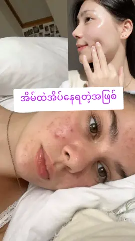 အိမ်ထဲပုန်းနေစရာမလိုဘူး#DOR #ဝတ်ခြံသမားတွေအတွက် #dornightcream #dordaycream❤ 