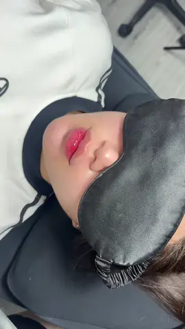 Nhìn cái môi thôi là nhắm mắt iu luôn đc rồi á 🥰 #fillerbotox #moithietke #phamthuhang 