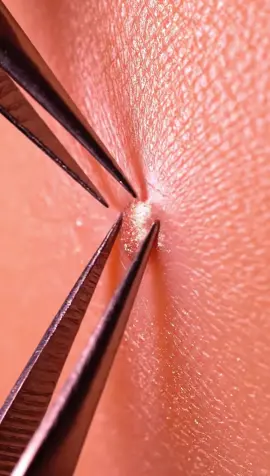 Copper wire pimple pop 🧵🪙🫧 Metallic shine, smooth tension, and perfectly satisfying ASMR. #ASMR #Slime #Satisfying #OddlySatisfying #AI
