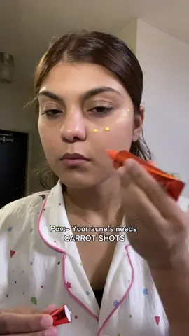 The magic carrot shot just  in 7 days  @APRILSKIN USA  APRILSKIN ✨😻 #APRILSKIN #APRILSKINskincare #carroteneclearingsolution #carrotshots #acnetreatment 