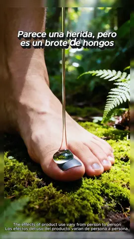 Si tú también tienes esta situación,ipuedes probar este método! #nails #tiktokshop #fyp#onicomicosis#TikTokShopfalldealsforyou