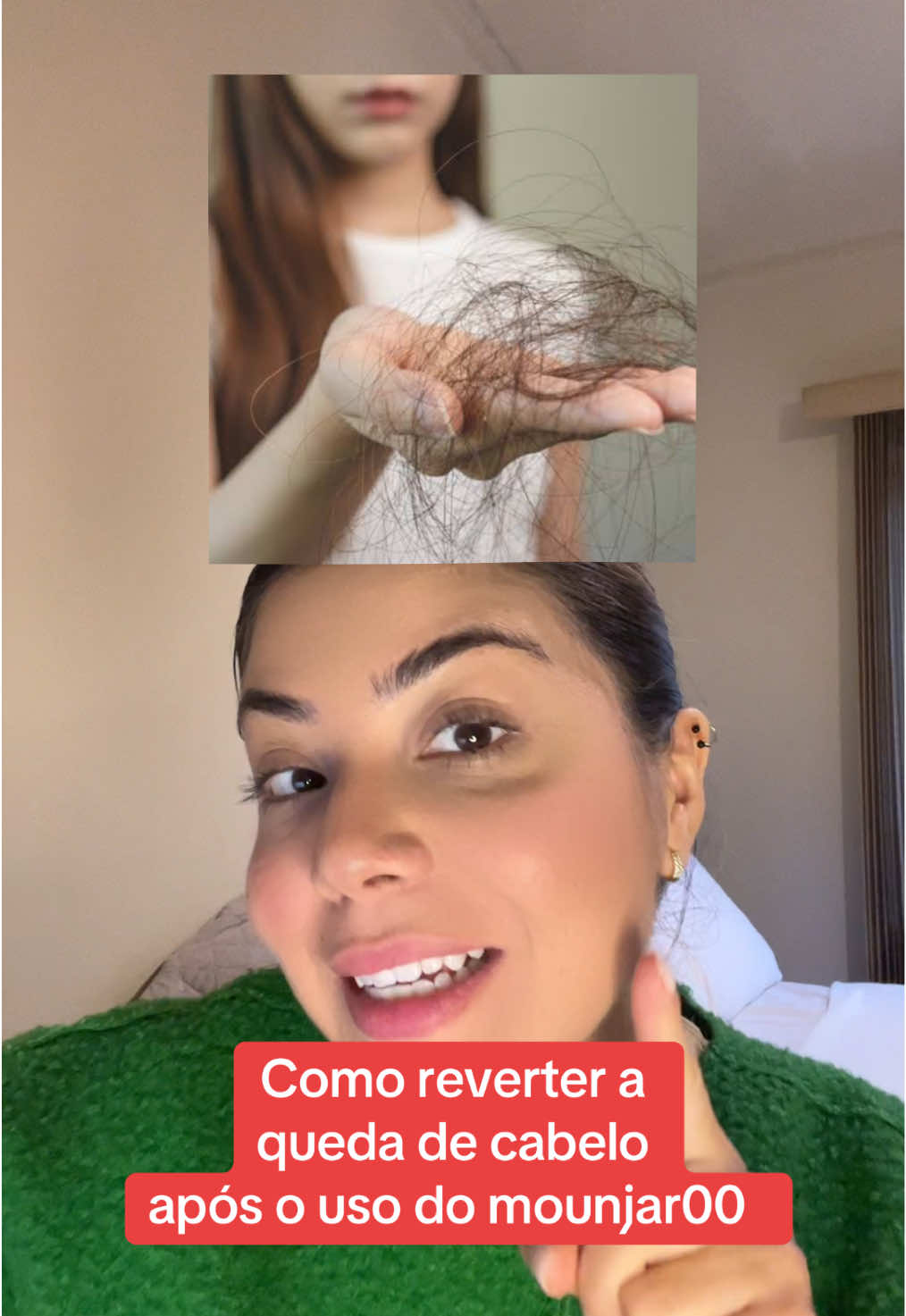 Está tomando monjar00 e ficando careca ? Corre pegar essa dica amiga ! #quedadecabelo #alopeciafeminina #mulheres #mounjaro #antesedepoismounjaro 