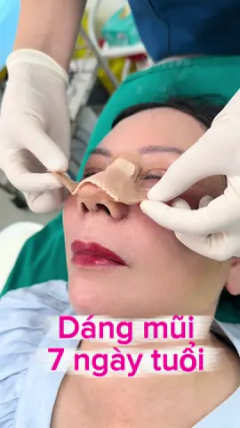 Dáng mũi cấu trúc 7 ngày tuổi đây các Chị ơi #nangmui #nangmuicautruc #nangmuidep #nangmuihcm #TikTokAwardsVN 