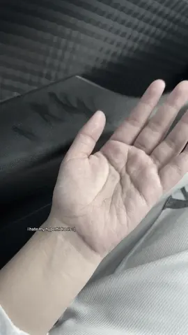 hmmm #hyperhidrosis#4u 