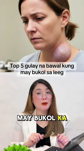 Episode 3 || 🥦 Mga Dapat Kainin Kung May Bukol sa Leeg Kapag may bukol sa leeg, mahalaga ang tamang pagkain para matulungan ang katawan na mag-detox, magpababa ng inflammation, at mapalakas ang immune system. Narito ang mga pagkaing makakatulong: Gulay na mataas sa antioxidants – tulad ng malunggay, spinach, kangkong, pechay, broccoli, at talbos ng kamote. ➤ Tumutulong itong linisin ang dugo at itaboy ang toxins na posibleng sanhi ng bukol. Prutas na hindi masyadong matamis – gaya ng mansanas, papaya, saging na saba, at citrus fruits (orange, calamansi). ➤ Mayaman ito sa Vitamin C na nagpapalakas sa immune system. Pagkaing mayaman sa iodine (para sa thyroid health) – tulad ng seaweeds (nori, kelp) at isdang galing sa dagat. ➤ Tumutulong ito sa maayos na function ng thyroid gland. Whole foods at fiber-rich foods – brown rice, oatmeal, chia seeds, at root crops tulad ng kamote at gabi. ➤ Nakakatulong sa maayos na paglabas ng toxins sa bituka. Tubig at natural detox drinks – uminom ng maraming malinis na tubig, at puwede rin ang warm water na may calamansi o luya sa umaga. ➤ Nakakatulong ito para sa natural na detoxification ng katawan. Healthy fats – gaya ng avocado, olive oil, at isdang may omega-3 (salmon, sardinas). ➤ Tumutulong sa pag-control ng inflammation sa katawan. This is a medical Advice #healthandwellness #bukol #thyroid #cyst #fyp 