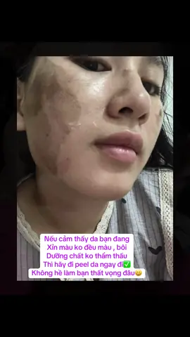Đẹp trấn động lun 😄 ko ngờ là sau 1b peel mix mà hiệu quả cỡ 5-60% lun đó